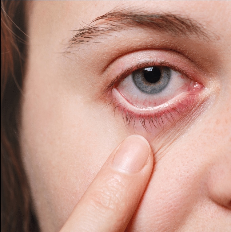 Fumo e salute oculare: Una connessione pericolosa